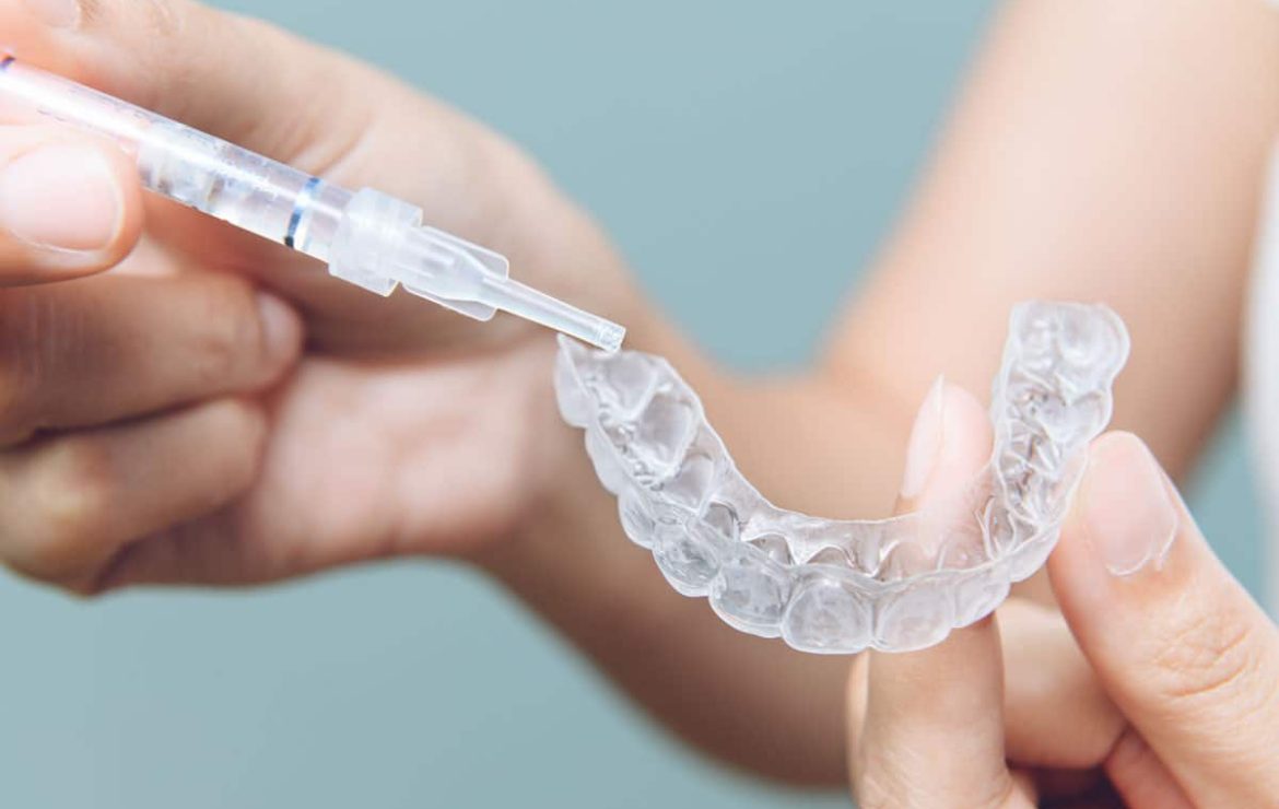 Teeth Whitening: how it is performed, duration and risks